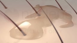 Sebum Pooling on the Surface of the Skin