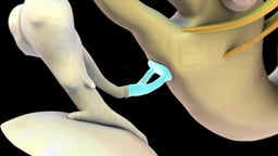 Close-Up of Stapes in the Middle Ear