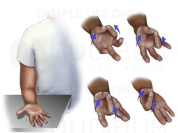 Thumb and Finger Opposition