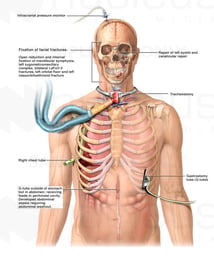 Multiple Surgical Treatments
