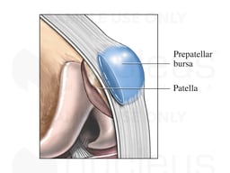 Pre-patellar Bursa