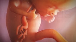 Duodenal Atresia and Repair (Pediatric)