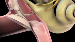 Middle Ear and Fluid in Eustachian Tube