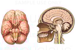 Normal Anatomy of the Brain and Cranium