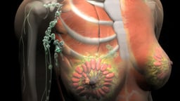 Breast Cancer Progression and Staging