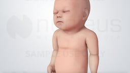 Infant Distress Warning Signs