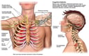 Various Internal Injuries of the Head, Neck and Torso