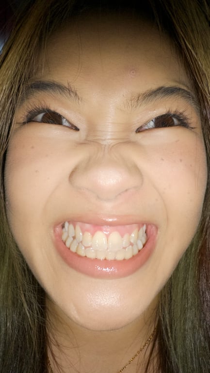 Aw Yong Li Yi