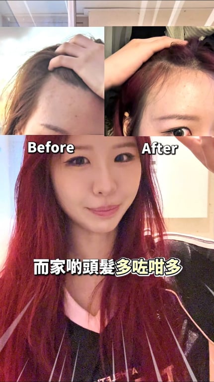 頭皮護理產品