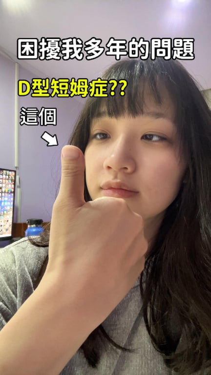 拇指長這樣好多年了🤣 有人跟我一樣嗎？