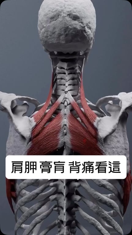 互動實測型 Reel:上背痛自我檢測教學,3,000+ 讚,留言區高互動追問