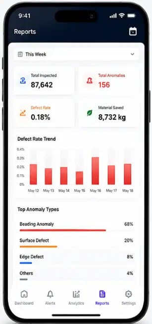 Anomaly Detection System