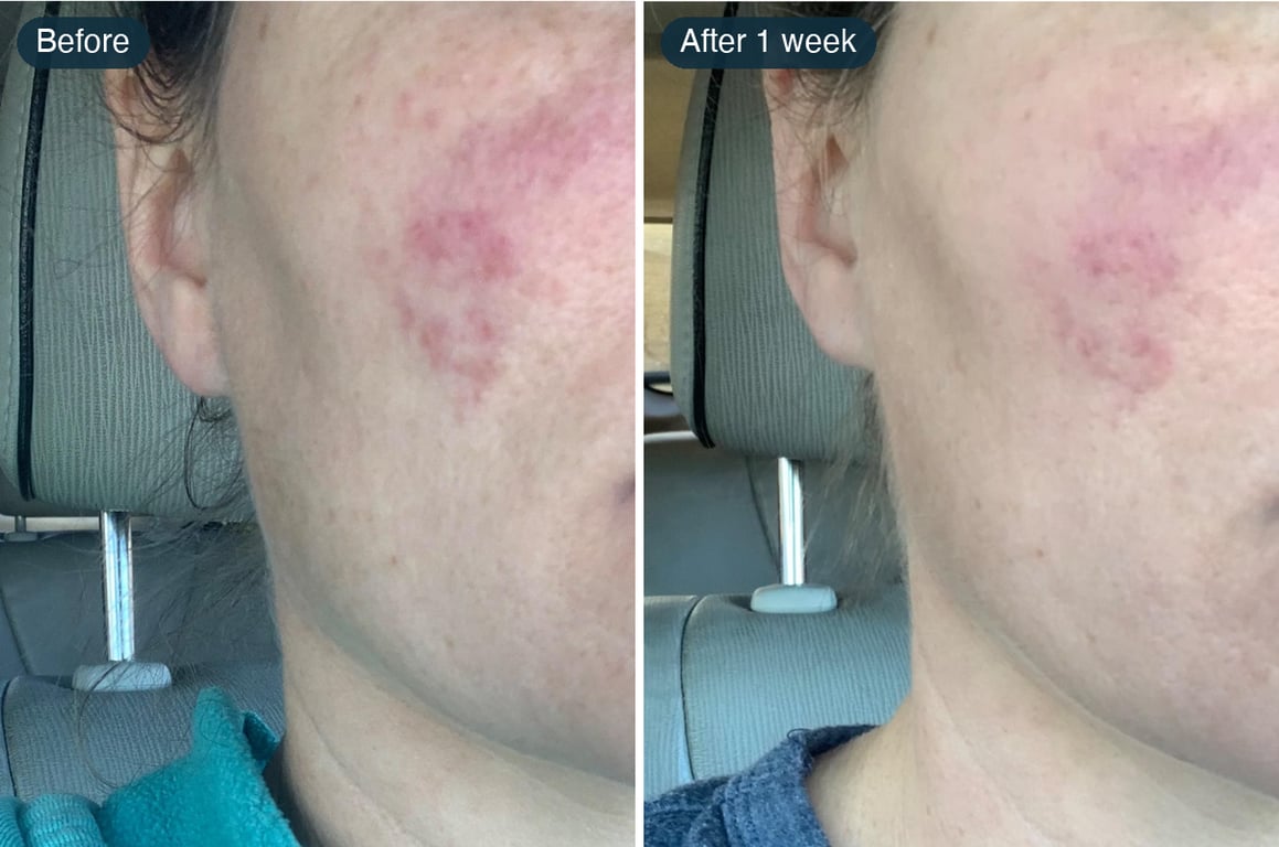 Nikki's own photos from her review: before, and after one week