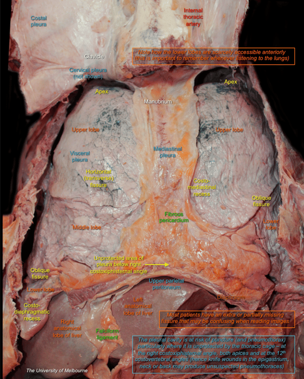 Pleural Cavity — MRCS Part B Anatomy