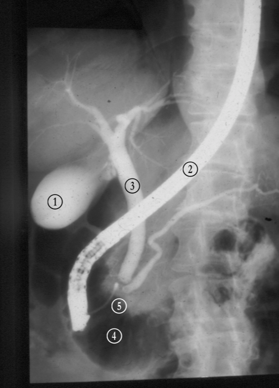 Biliary System — MRCS Part B Anatomy