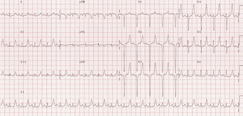 Potassium — MRCS Part B Applied surgical science and critical care