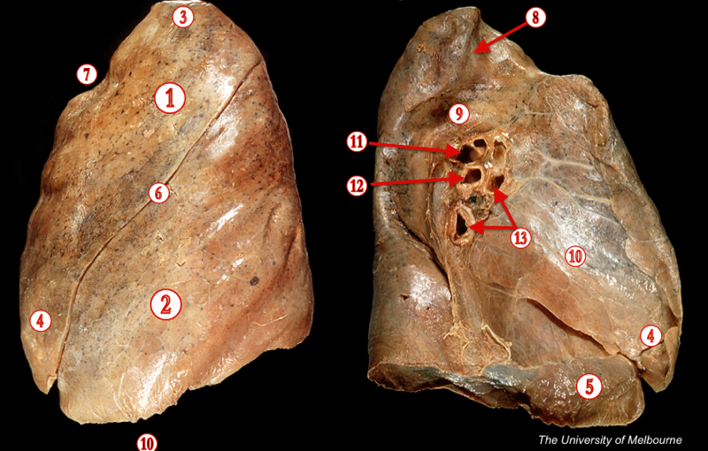 Lungs — MRCS Part B Anatomy