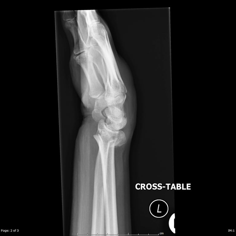 Explaining A Diagnosis — The gentleman’s radiograph is shown. What does it show?