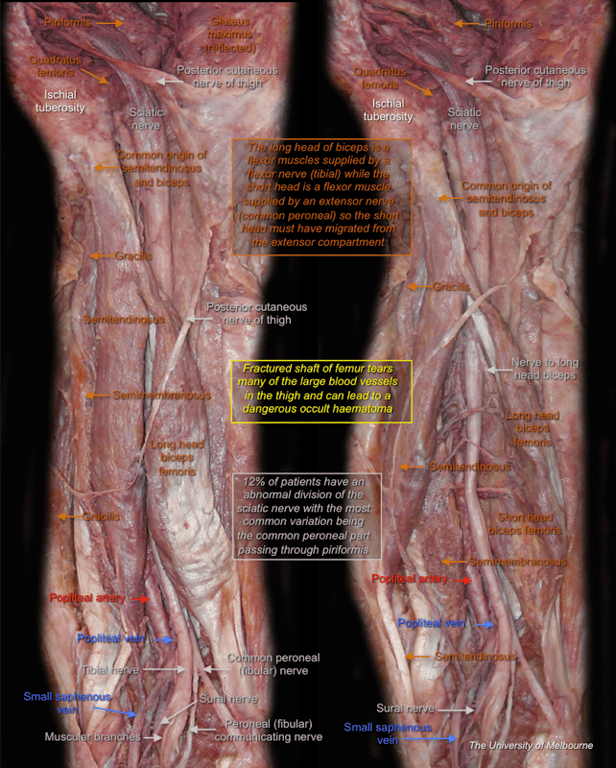 Thigh — MRCS Part B Anatomy