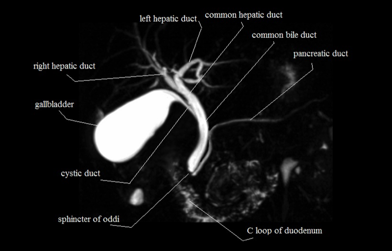 Biliary System — MRCS Part B Anatomy