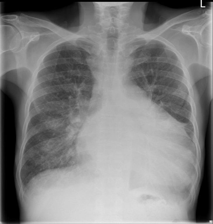 JVP — MRCS Part B Applied surgical science and critical care