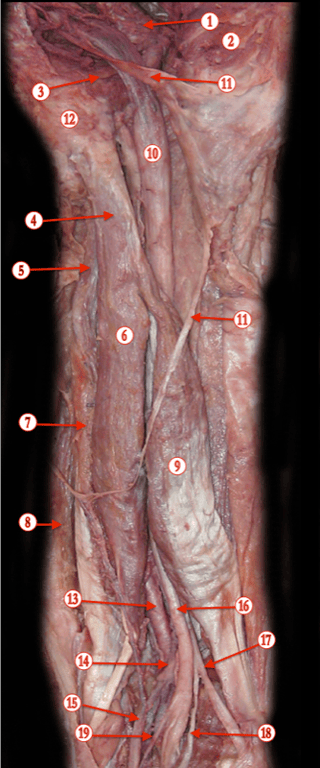 Thigh — MRCS Part B Anatomy