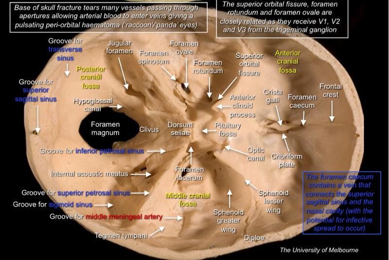 Skull Vault — MRCS Part B Anatomy