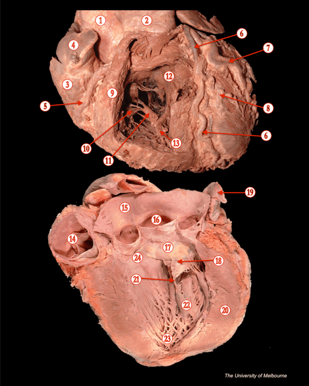 Heart 2 — MRCS Part B Anatomy