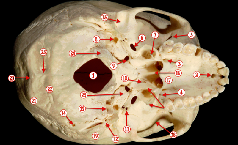 Brain — MRCS Part B Anatomy