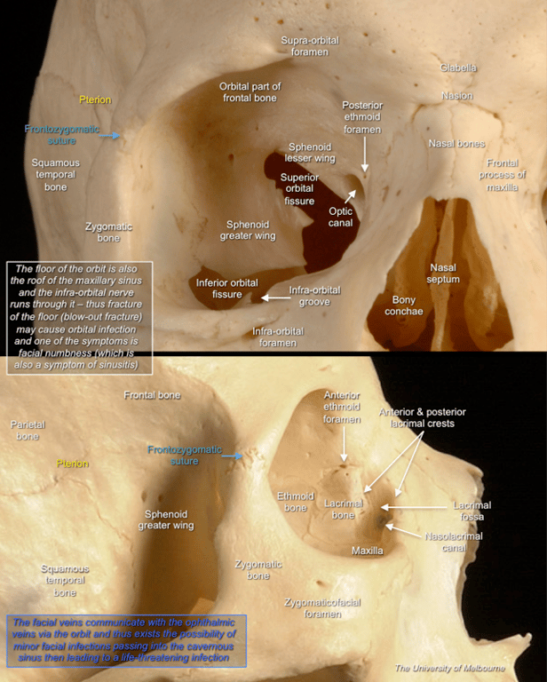 Orbit — MRCS Part B Anatomy