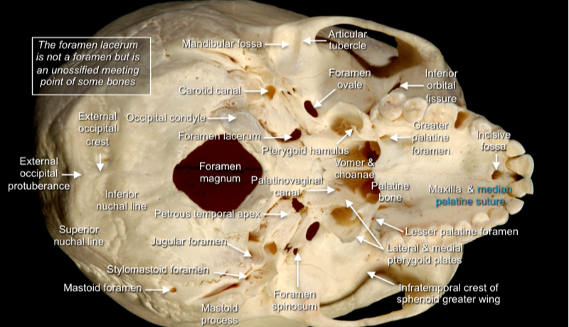Brain — MRCS Part B Anatomy