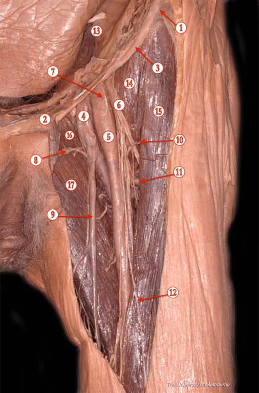 Femoral Region — MRCS Part B Anatomy