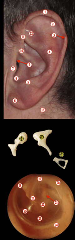 Ear — MRCS Part B Anatomy
