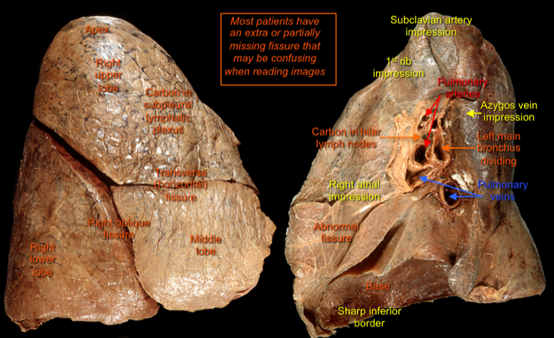 Lungs — MRCS Part B Anatomy