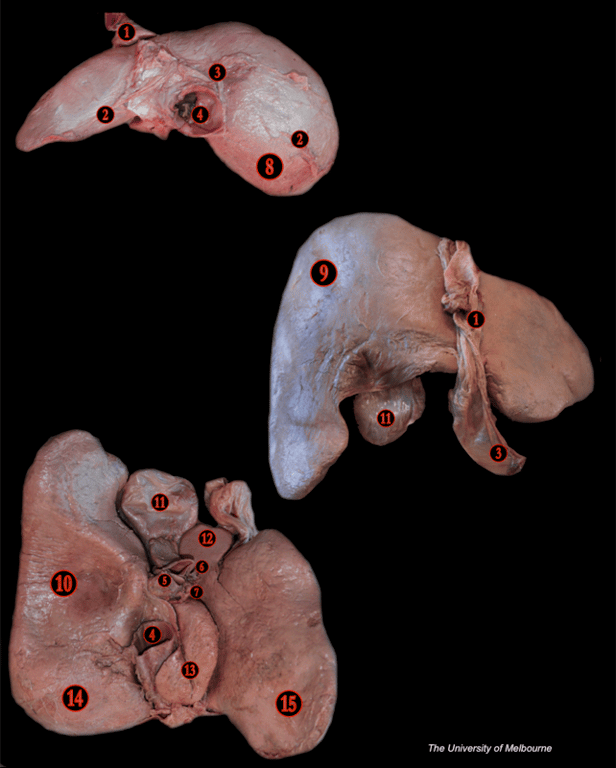 Liver — MRCS Part B Anatomy