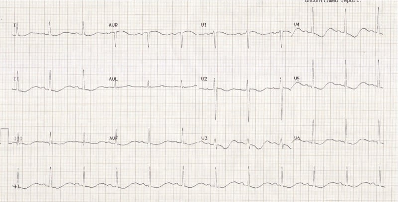 Potassium — MRCS Part B Applied surgical science and critical care
