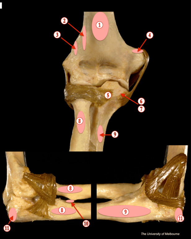 Elbow — MRCS Part B Anatomy