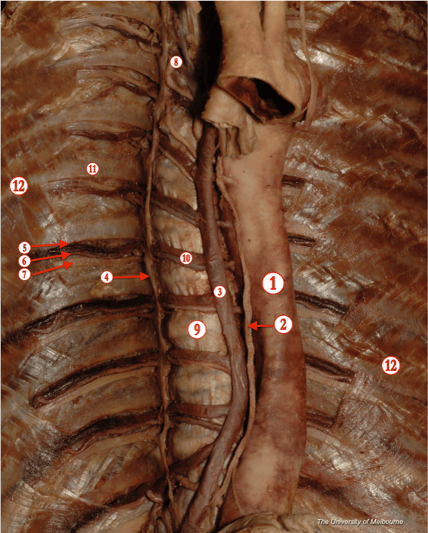 Intercostals — MRCS Part B Anatomy