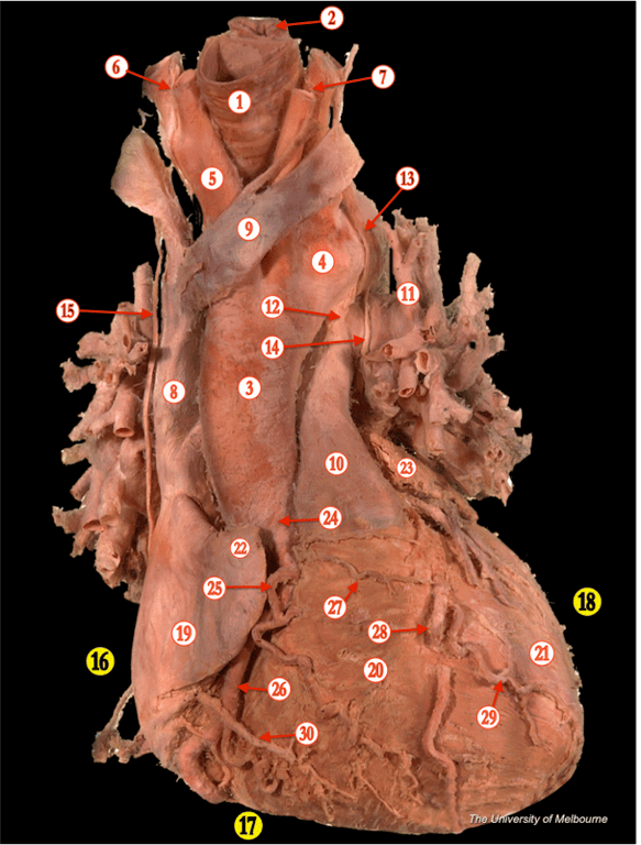 Heart 1 — MRCS Part B Anatomy