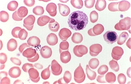 Haematology — MRCS Part B Surgical pathology