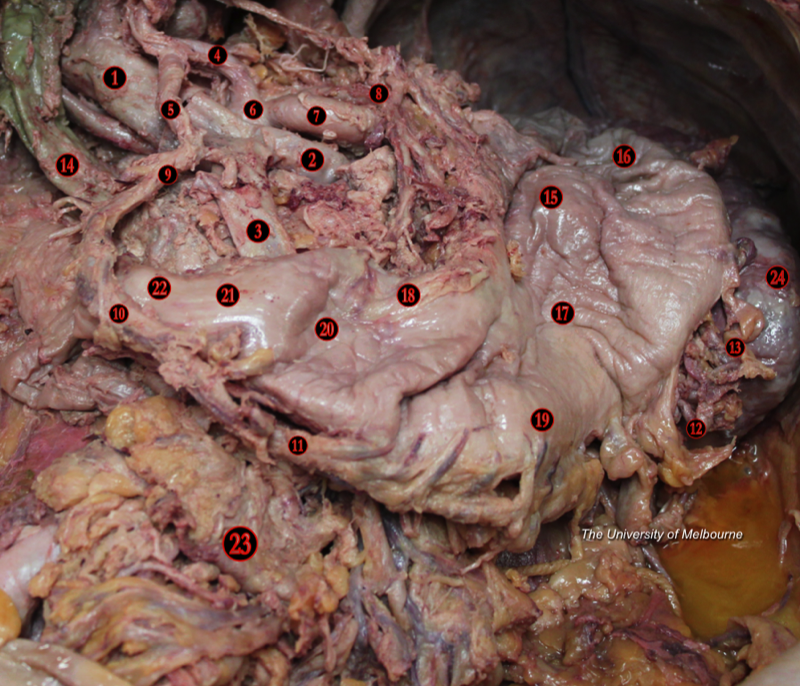 Stomach — MRCS Part B Anatomy
