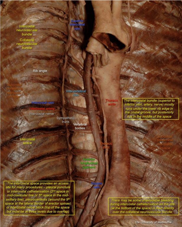 Intercostals — MRCS Part B Anatomy