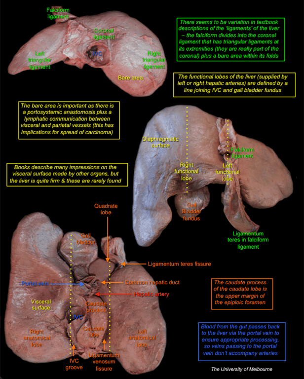 Liver — MRCS Part B Anatomy