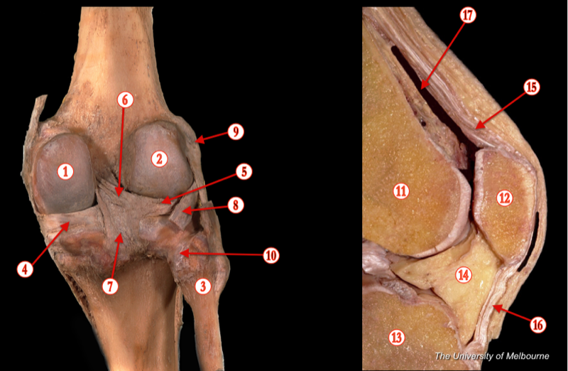 Knee 1 — MRCS Part B Anatomy