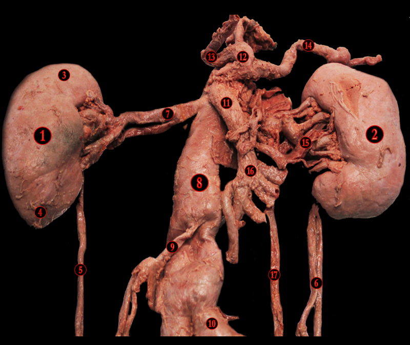 Urinary System — MRCS Part B Anatomy