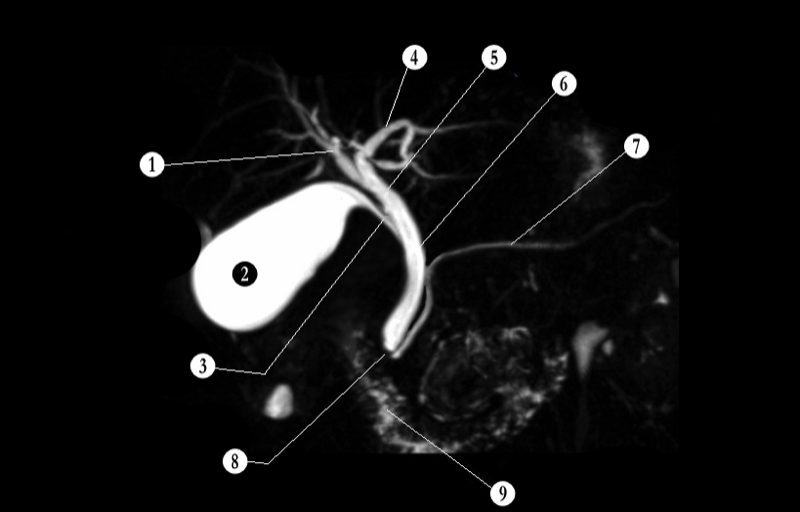 Biliary System — MRCS Part B Anatomy