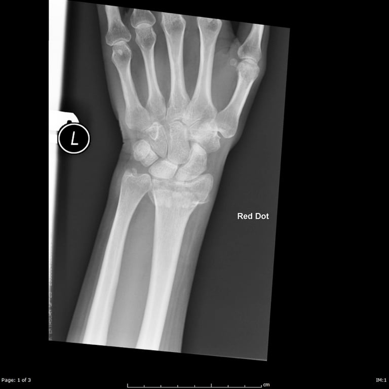 Explaining A Diagnosis — The gentleman’s radiograph is shown. What does it show?