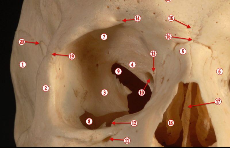Orbit — MRCS Part B Anatomy
