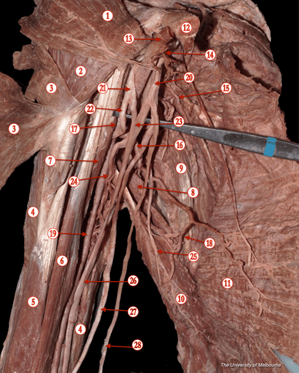 Brachial Plexus 1 — MRCS Part B Anatomy