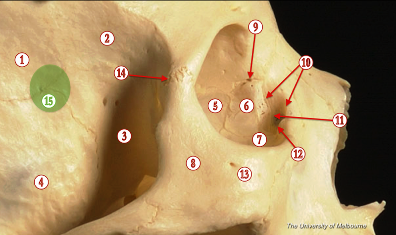 Orbit — MRCS Part B Anatomy